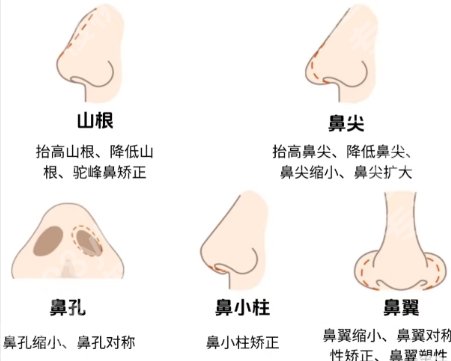 车金昊医生隆鼻怎么样？医生基本信息|隆鼻案例展示！来看效果
