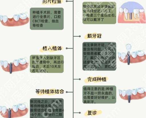 廊坊种牙几个地方可以种?公立/私立名单汇总!市人民医院位列前三