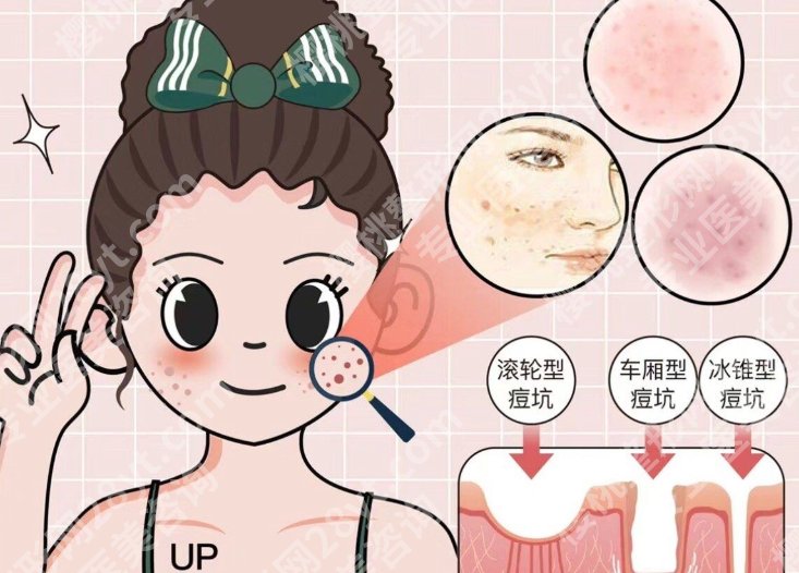 宁波激光祛斑三甲医院有哪些？公立院皮肤科盘点，正规祛斑认准这几家