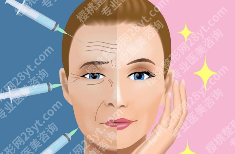 长沙除皱哪家好？热门抗衰机构大盘点，选对方案年轻感真的不一样