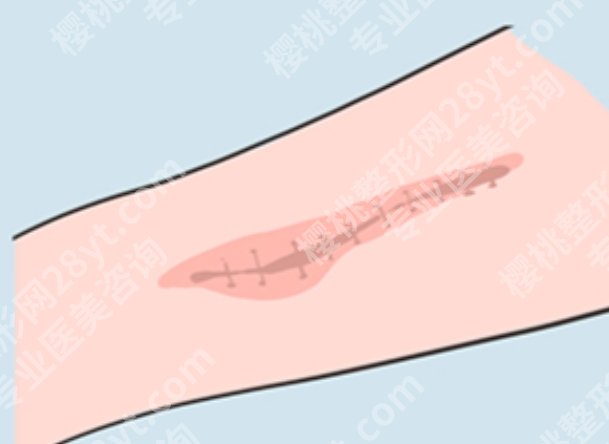 盐城祛疤痕医院哪家好？能做疤痕修复的正规机构帮你筛好了，别乱花钱