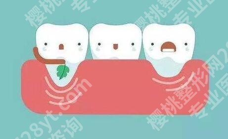 北京种牙好的医院是哪家？这几家被点名多的机构终于曝光了