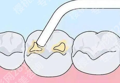 常州种植牙哪家医院好？这5家闭眼冲不踩坑