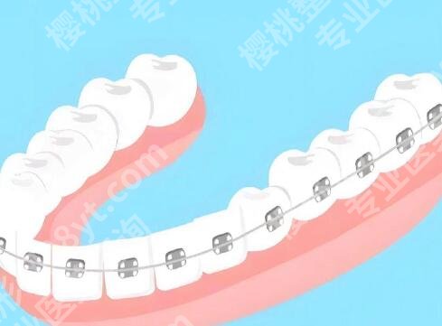 东莞种牙哪里好？这5家医院综合实力强