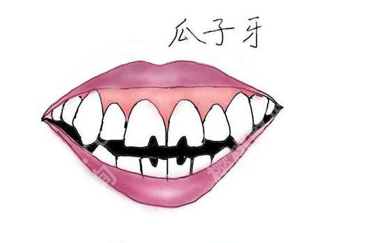 贵阳种牙哪家好？靠谱口腔医院大盘点，速看