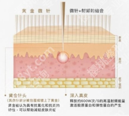 潍坊点阵激光多少钱一次？2026新价格整理，附术后护理注意事项