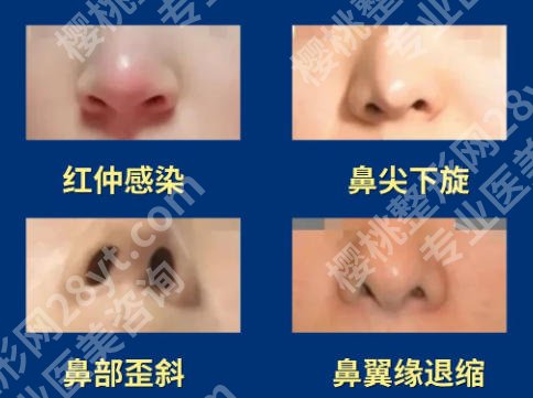 龙鹏辉医生优势怎么样?含医生详细介绍及真实口碑点评来袭！