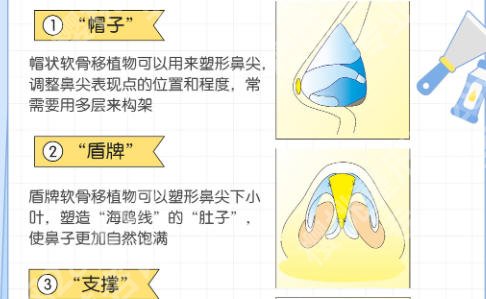 潘峰医生分段式隆鼻效果好不好?医生资料及经典案例反馈!