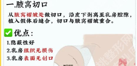 沈正宇医生口碑怎么样？医生简介、擅长项目及坐诊医院介绍！