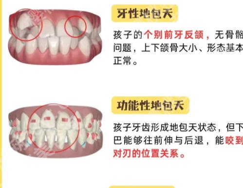 徐州好的矫正牙科医院有哪些？靠谱牙齿矫正医院排名揭晓！