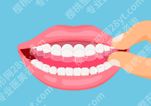 湖州牙齿矫正哪家医院好？口碑、医生实力、矫正方式多维对比