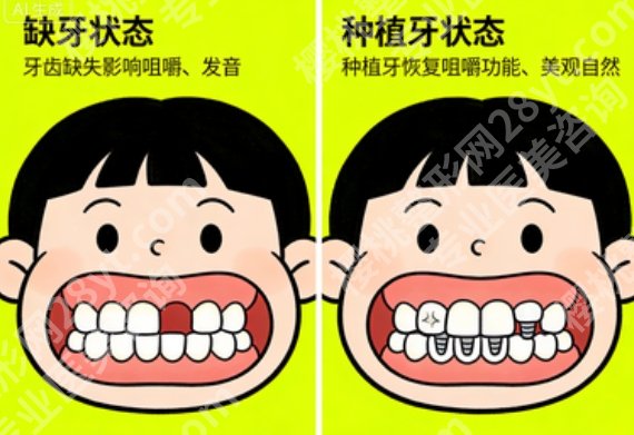 长春满口种植牙价格一览，全口各方案费用大公开，缺牙多的先看明白