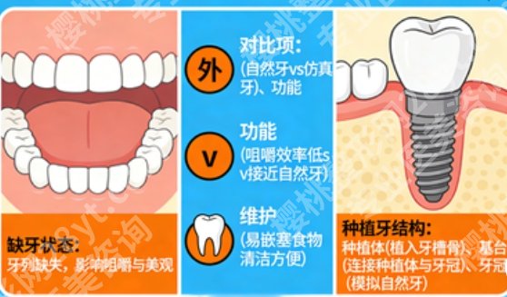 江门全口种植牙哪家好？做全口这几家技术口碑都在线，缺牙党速看