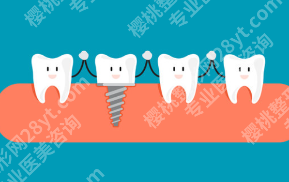 呼和浩特种植牙哪里好?看完这几个重点,再决定去哪家更稳妥