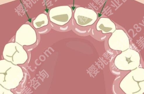 宝坻口腔医院哪个好？5家公立老牌机构实测，不踩坑不忽悠