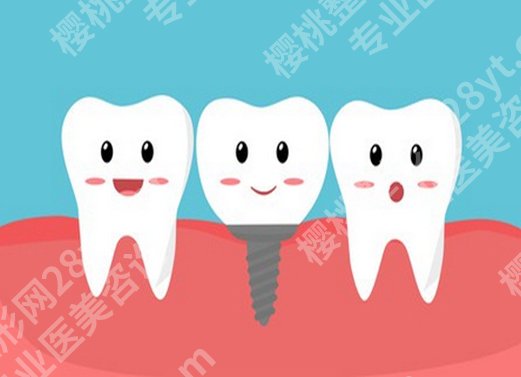 金华满口种植牙多少钱？2026新价目表+避坑指南在线分享