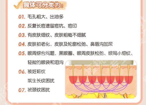 广州黄金微针美容医院推荐来袭！优选这几家医院上榜