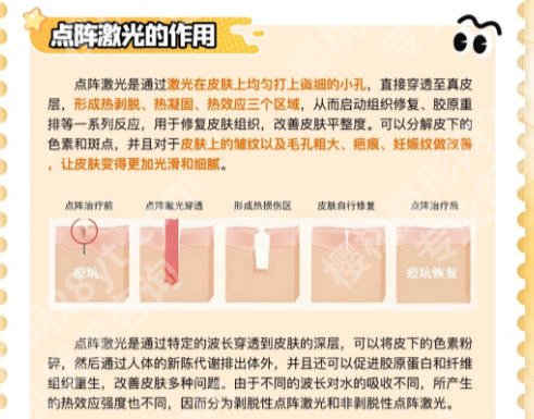 宿州市立医院点阵激光多少钱？附有相关的医生信息和真实案例分析