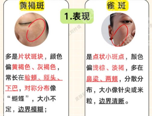菏泽有没有专业祛斑医院？本地医院详细介绍和顾客点评分享！