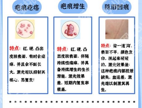 阜阳激光去疤痕价格表新鲜出炉！价格一般5k起步附医院详细介绍
