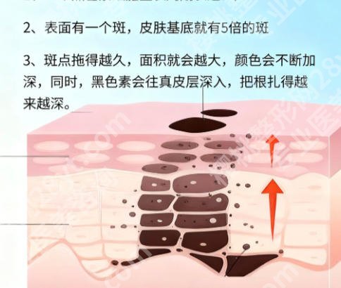 龙岩第一医院有激光祛斑吗？内附医院信息＋口碑评价