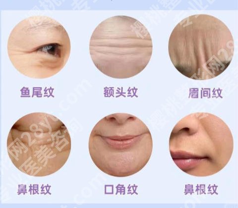 无锡除皱整形医院有哪些？这五家医院个个实力派
