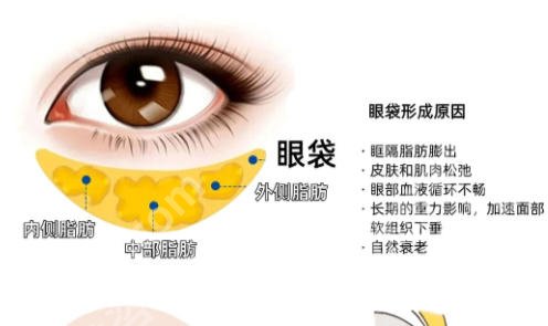 常州祛眼袋手术哪家好？这份排名榜帮你避坑！
