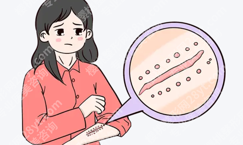 安阳市有去疤痕的医院吗？看诊方向和选择重点一次说清
