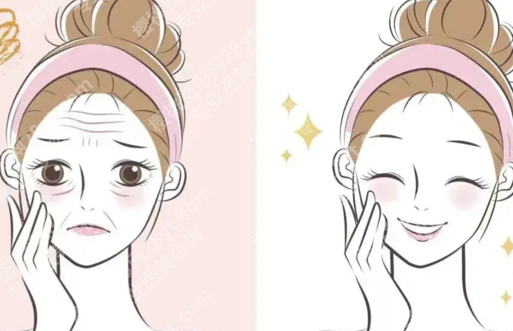 大连除皱好的医生怎么选更靠谱？技术审美和经验缺一不可