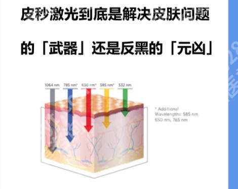 无锡皮秒激光厉害三个地方有哪些？这几家医院效果不错值得信赖！