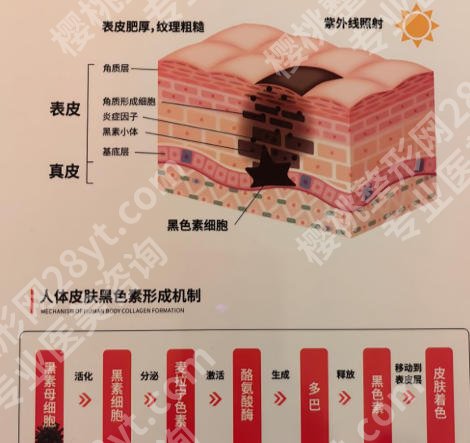 衢州激光祛斑哪家好?排名前三大医疗机构揭晓