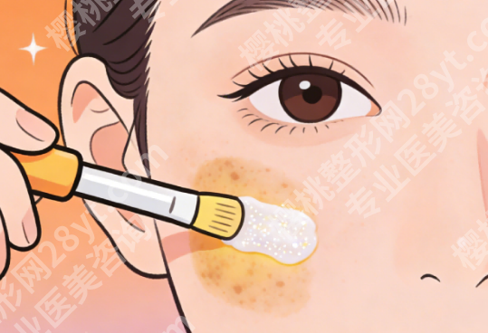 南昌皮秒祛斑的费用一般是多少？一次多少钱看完心里就有数