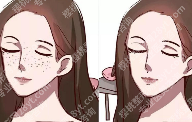 深圳皮秒激光祛斑的价格是多少？从医院报价到疗程预算，这篇讲得很明白