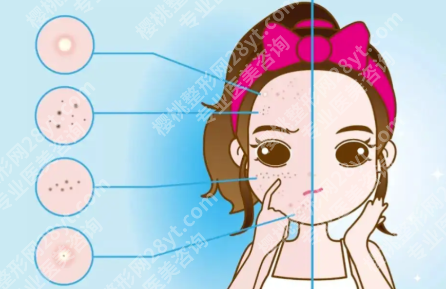 南京皮肤病研究所点阵激光多少钱？项目费用和适合人群都在这