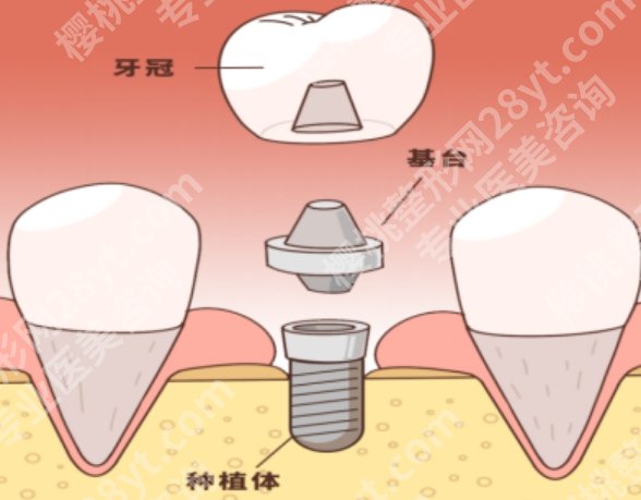 商丘牙齿矫正哪个医院好？技术、审美、服务体验都得认真比