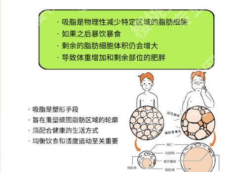 罗明生吸脂的口碑评价怎么样？本地吸脂专家实力分析来袭！