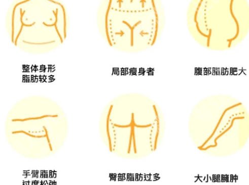 罗明生吸脂的口碑评价怎么样？本地吸脂专家实力分析来袭！