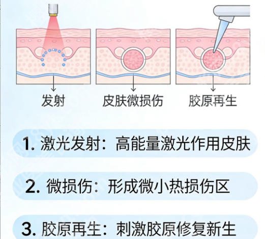 重庆点阵激光做得好的医院有哪些?这些信息你必须知道