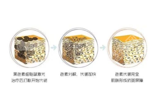 贵州省人民医院皮秒多少钱？大概3K起、唐修俊医生实测+顾客真实反馈