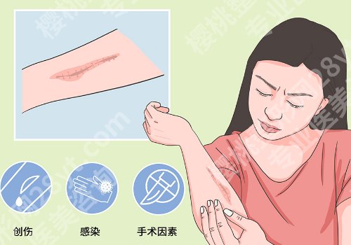 潍坊祛疤痕医院哪家好？Top榜单更新、从技术到口碑深度解析！
