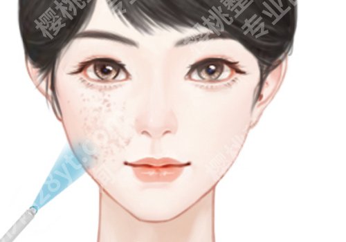 北京皮秒祛斑多少钱一次？北京八大处/中日医院等院低至1500元起