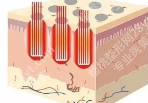 贵阳做点阵激光好的医院有哪些？医科大附院/省人民医院等曝光