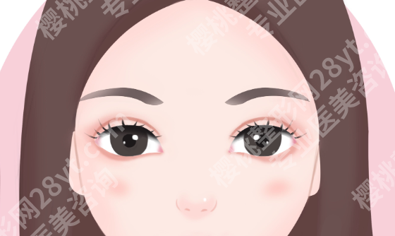 北京双眼皮修复医院排行参考，失败眼修复前建议先做功课