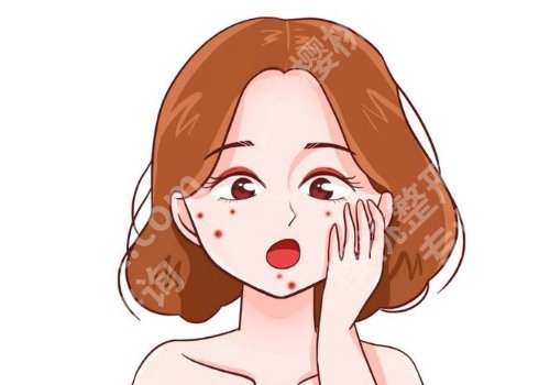 湖州点阵激光医院排名!详情与pk,轻松获得好肌肤