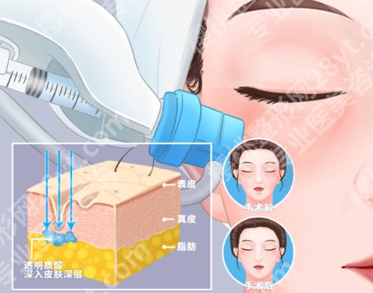 大连整容医院哪家好啊?正规医院名录公布!点击收藏