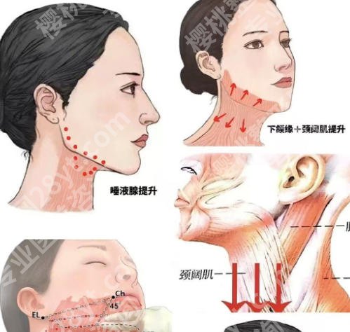 长沙注射玻尿酸哪里好？省人民医院、湘雅医院排名靠前！