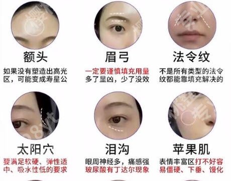 南京面部填脂哪家好？top榜前五名单更新！速速码住