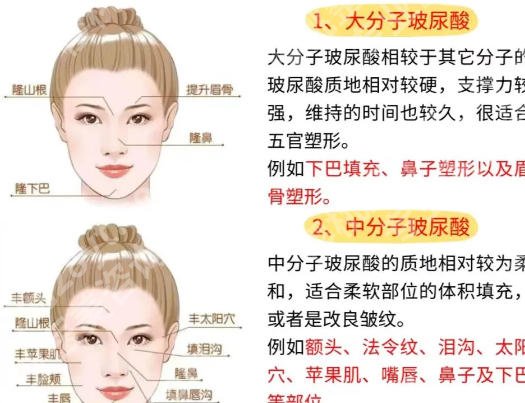 长沙注射玻尿酸好的医生名单更新！雷少榕、李晓芳技术值得信赖！