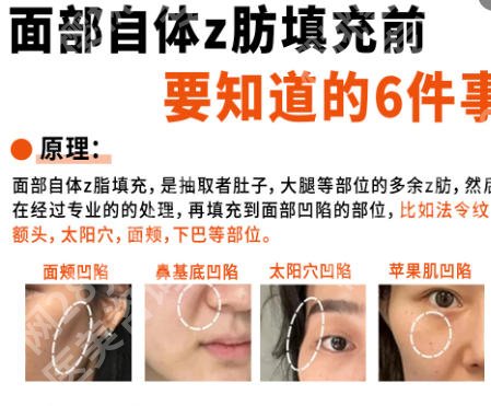 济南面部脂肪填充专家名单出炉！全网深扒这几位实力专家！