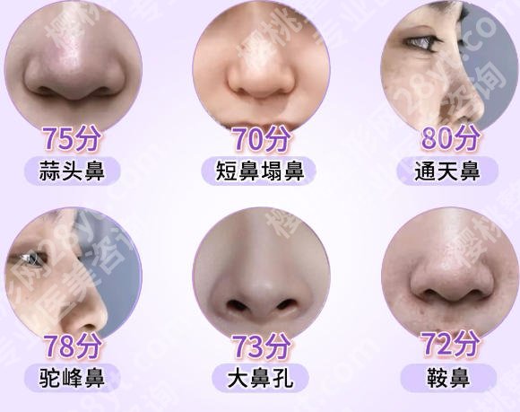 上海第八人民医院假体隆鼻怎么样?2026收费标准更新!含技术点评